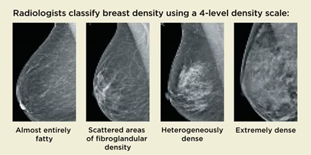 Breast Density