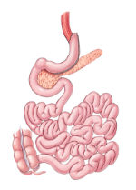 illustration of gastric sleeve