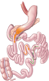 Duodenal Switch diagram