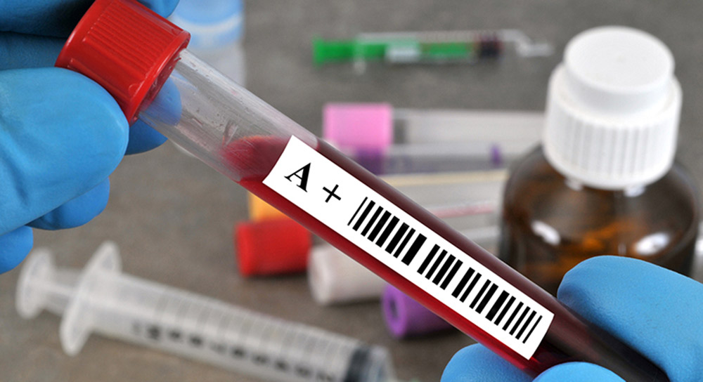 Close up of a blood vial reading "A+" held by surgical gloved hands