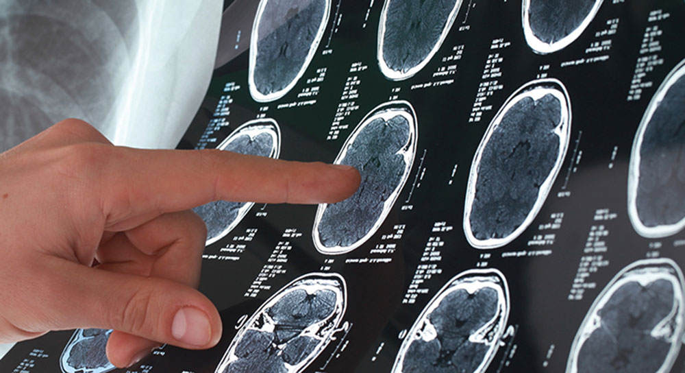 A white hand points to a scan showing multiple images of a human brain